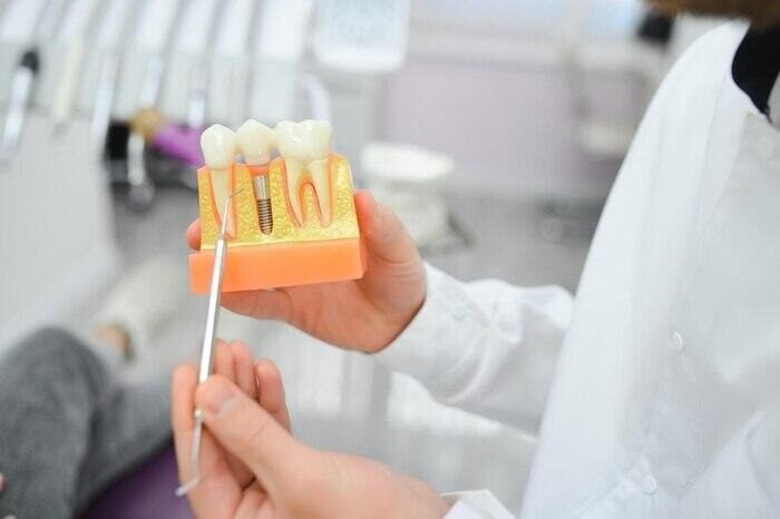 Picture3 Oral Surgery Courses: Why Consider Them?